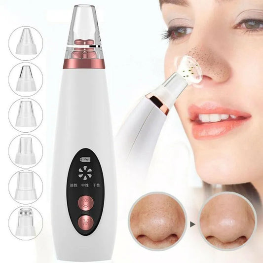 Advanced Blackhead Remover & Skin Rejuvenation Device